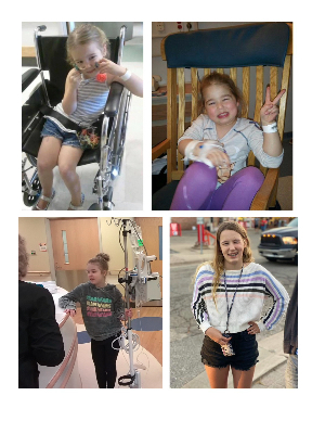 Brynn age 5 before & after treatment; age 10; age 14